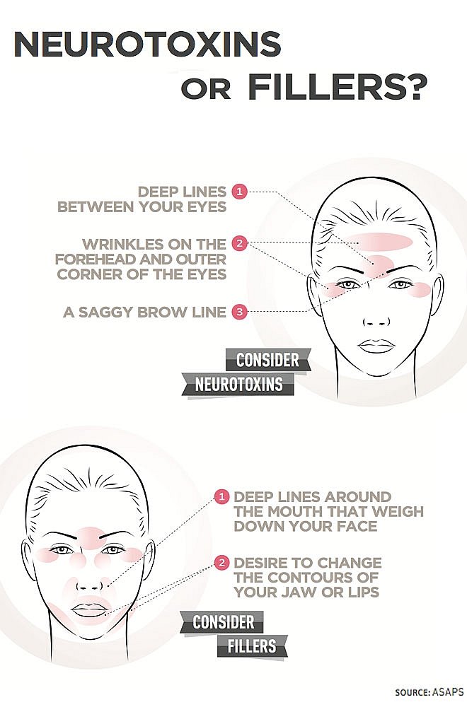 Infographic Neurotoxins Or Fillers Bay Pointe Dermatology